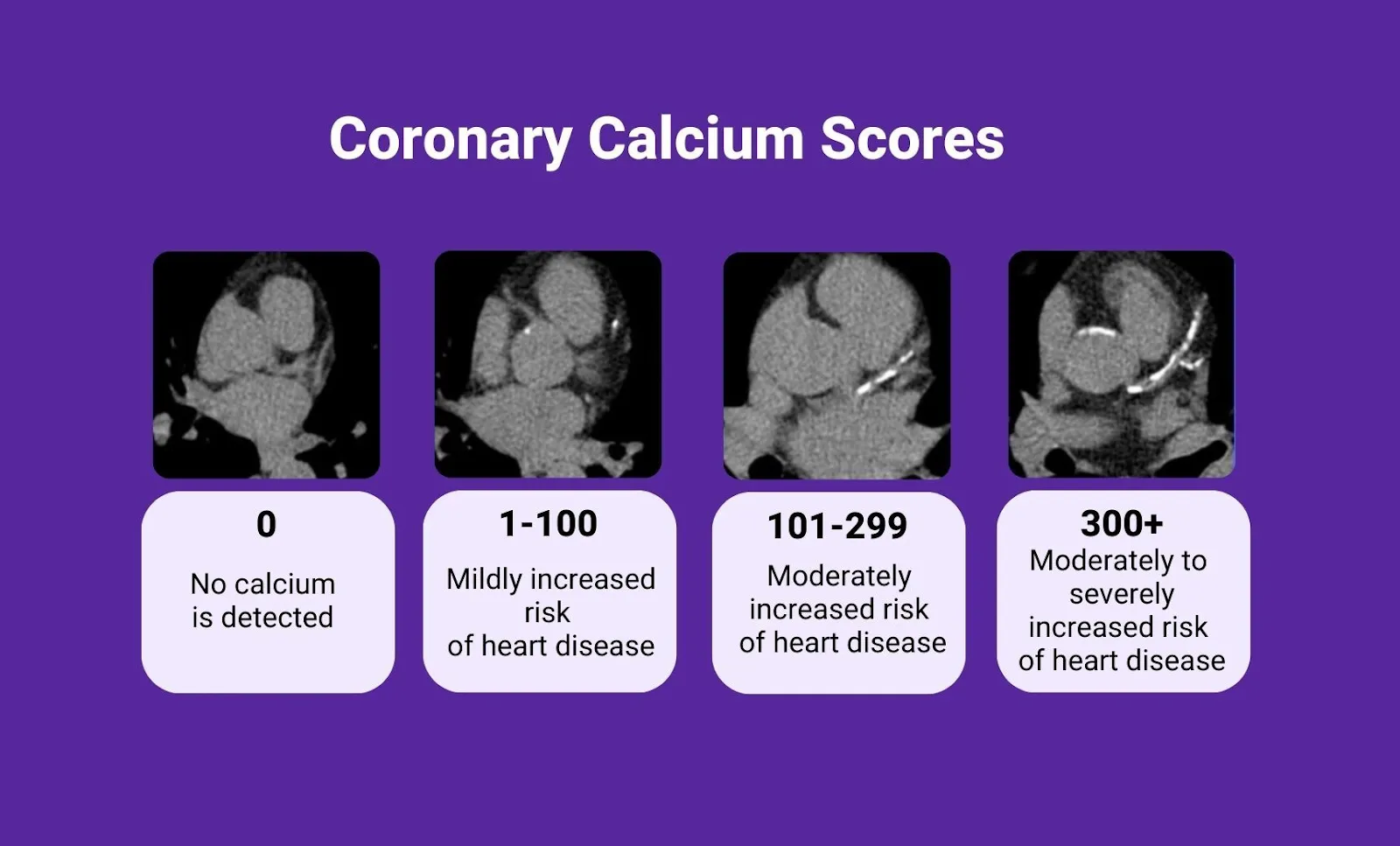 calcium score ct